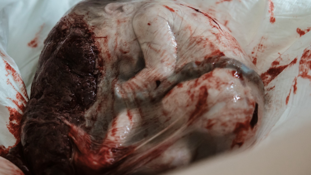 Prijswinnende foto in de categorie net na de bevalling